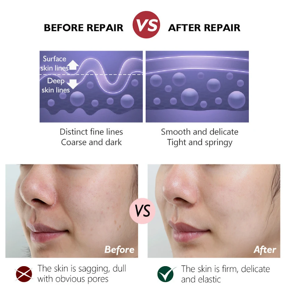Crème Activante Raffermissante au Rétinol pour une peau plus ferme. Réduit les rides, hydrate et rajeunit la peau. Obtenez un teint plus jeune.