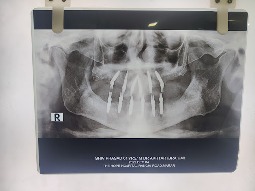 City Dental Care -Dentist in Ramgarh — business photo 4