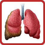 Cover Image of Download Guess Mesothelioma 7.1.3z APK