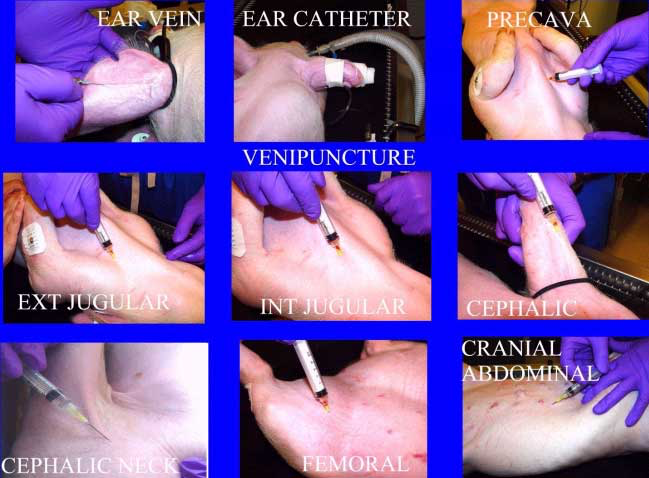 Venous access sites.