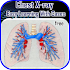 Chest X-ray Easy Learning5.1.9