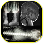 Cover Image of ดาวน์โหลด Musculoskeletal X- Rays 1.0 APK