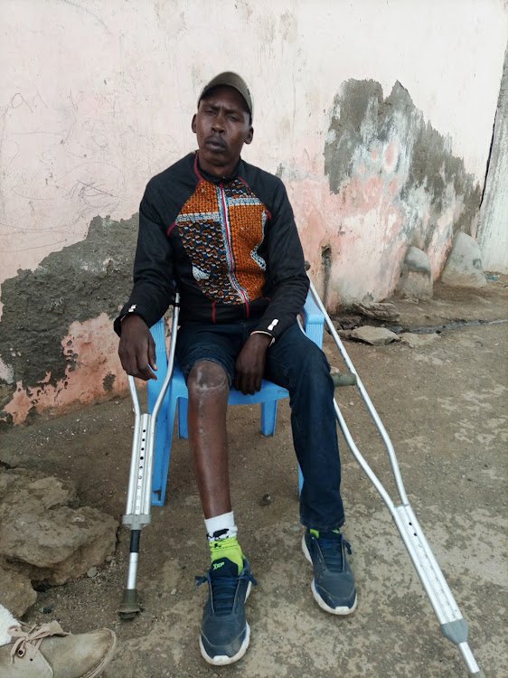 Samson Okoilel of Kasarani estate lost a knee cap and one buttock in a hippo attack in Lake Naivasha.