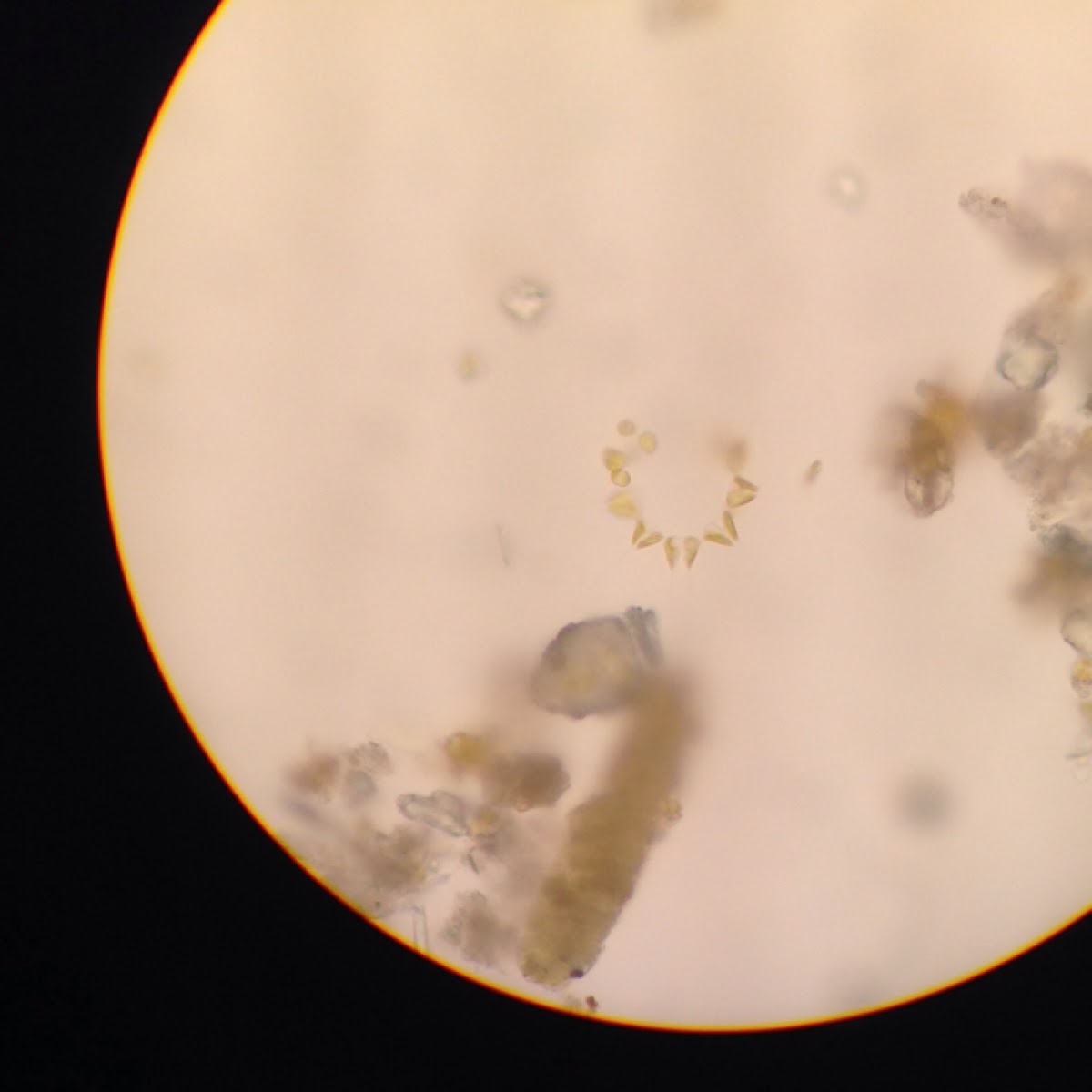 Diatom