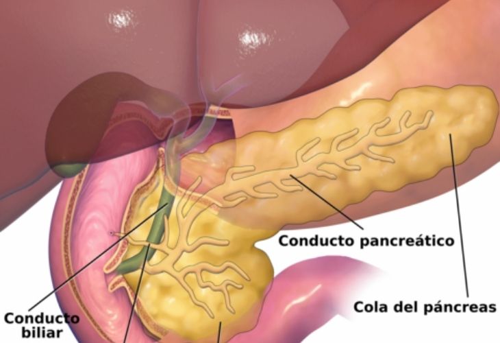 Causas Del Dolor Estomacal Después De Comer Pancreatitis y cálculos biliares