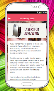 HOW TO GET RID OF ACNE SCARS(圖3)-速報App
