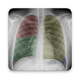 Download CHEST X RAY MASTER For PC Windows and Mac