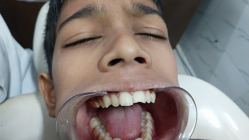 SHREE SAMARTH DENTAL CLINIC AND IMPLANT CENTER — business photo 8